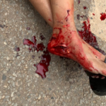 Cão raivoso ataca pedestre e PM intervém em situação crítica no oeste de Goianésia