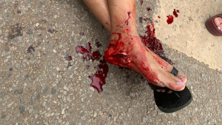 Cão raivoso ataca pedestre e PM intervém em situação crítica no oeste de Goianésia