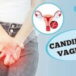 Candidíase Vaginal: o que é, sintomas, diagnóstico, tratamento e prevenção Candidíase Vaginal: o que é, sintomas, diagnóstico, tratamento e prevenção
