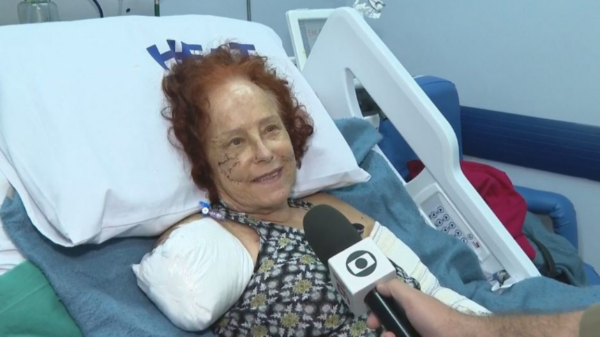 Roseana Murray Usa Prótese Biônica Após Perder Braço em Ataque de Pitbulls Roseana Murray Usa Prótese Biônica Após Perder Braço em Ataque de Pitbulls