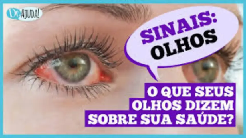 Sinais que os olhos podem revelar sobre a saúde Sinais que os olhos podem revelar sobre a saúde