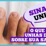 Dr. Ajuda: Unhas fracas podem indicar problemas de saúde Dr. Ajuda: Unhas fracas podem indicar problemas de saúde
