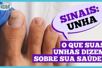 Dr. Ajuda: Unhas fracas podem indicar problemas de saúde