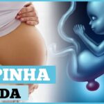 O que é e como prevenir a mielomeningocele?