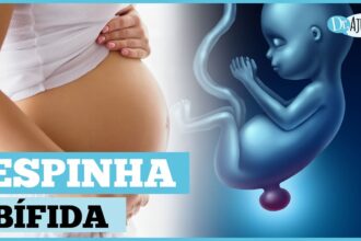 O que é e como prevenir a mielomeningocele? O que é e como prevenir a mielomeningocele?