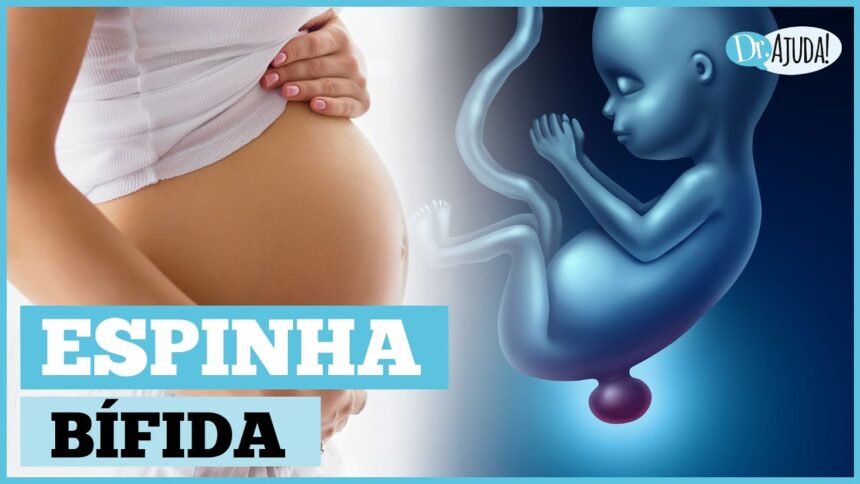 O que é e como prevenir a mielomeningocele? O que é e como prevenir a mielomeningocele?