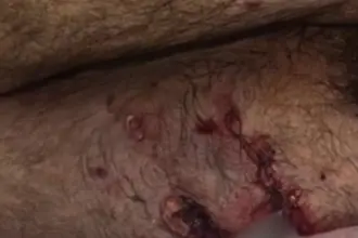 Ataque de pitbull deixa homem ferido no oeste de Goianésia