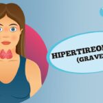 Hipertireoidismo, o que é? Hipertireoidismo, o que é?