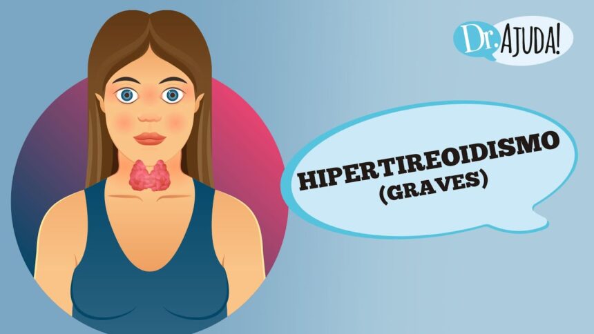 Hipertireoidismo, o que é? Hipertireoidismo, o que é?