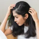 4 dicas para tratar a caspa sem agredir os cabelos