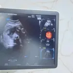 Renato de Castro anuncia parceria com deputada Flávia Moraes e traz clínica móvel com exames gratuitos