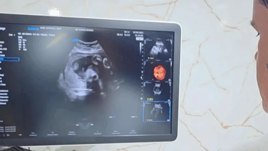 Renato de Castro anuncia parceria com deputada Flávia Moraes e traz clínica móvel com exames gratuitos Renato de Castro anuncia parceria com deputada Flávia Moraes e traz clínica móvel com exames gratuitos