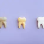 5 mitos e verdades sobre manchas nos dentes