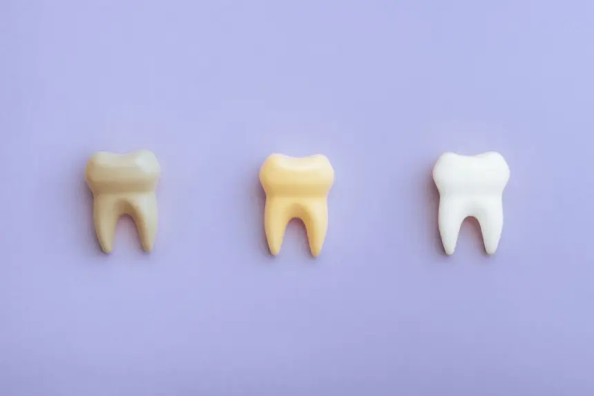 5 mitos e verdades sobre manchas nos dentes