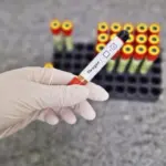 Período chuvoso pede mais atenção contra a dengue – Portal Goiás