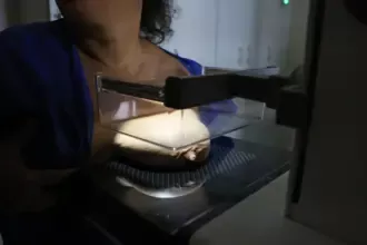 Vigitel: 92% das brasileiras entre 50 e 69 anos fizeram mamografia