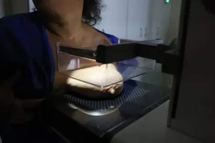 Vigitel: 92% das brasileiras entre 50 e 69 anos fizeram mamografia