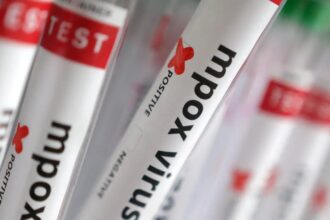 Sobe para 140 número de casos confirmados de Mpox no país, em 2026