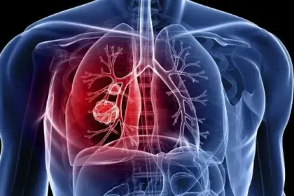 Ceap-Sol alerta para importância do diagnóstico precoce no combate à tuberculose