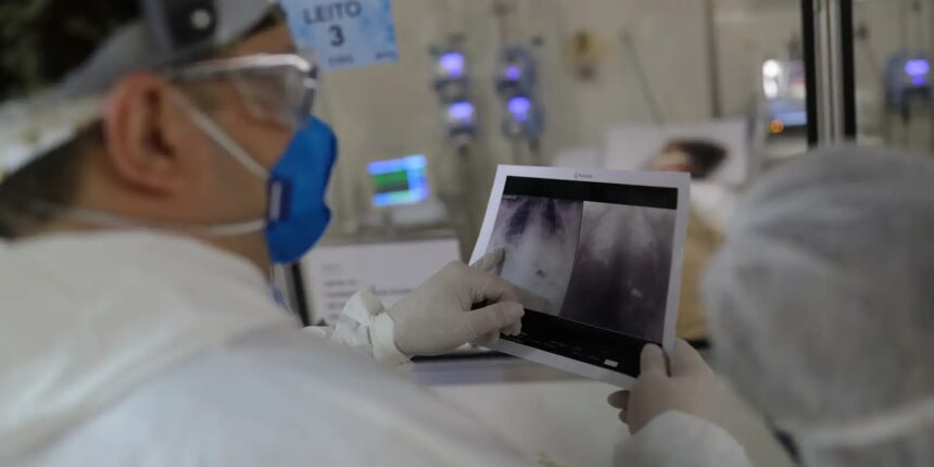 Broncopneumonia: entenda quadro que causou internação de Bolsonaro Broncopneumonia: entenda quadro que causou internação de Bolsonaro