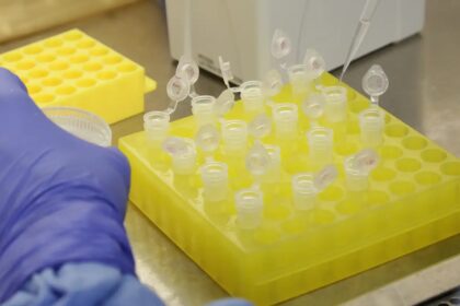 SP confirma segundo caso importado de sarampo