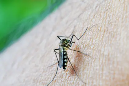 Estudo alerta para relação da dengue com a Síndrome de Guillain-Barré