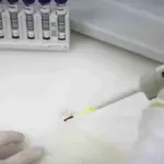 Paciente em SP com suspeita de ebola testa positivo para meningite