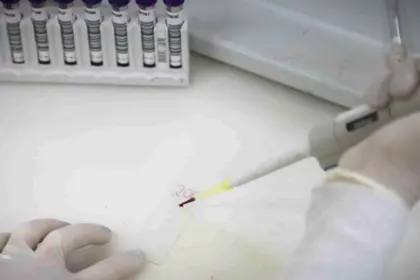 Paciente em SP com suspeita de ebola testa positivo para meningite